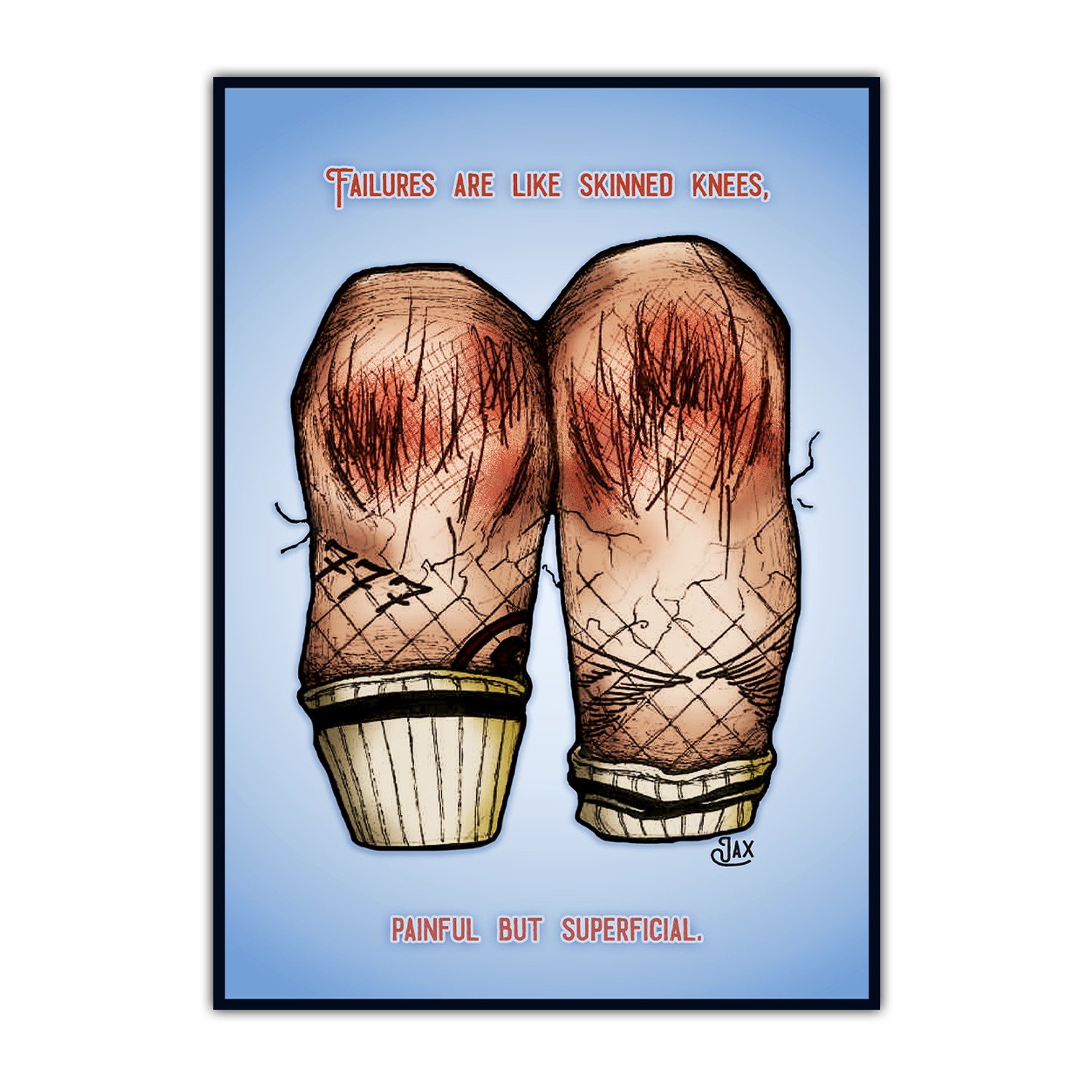 Skinned Knees Print